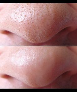 Tuýt lột mụn đầu đen hoàn hảo Blackhead out của The Face Shop