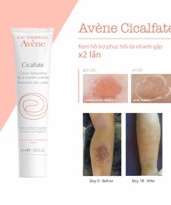 Kem trị sẹo thâm Avene Cicalfate Repair Cream