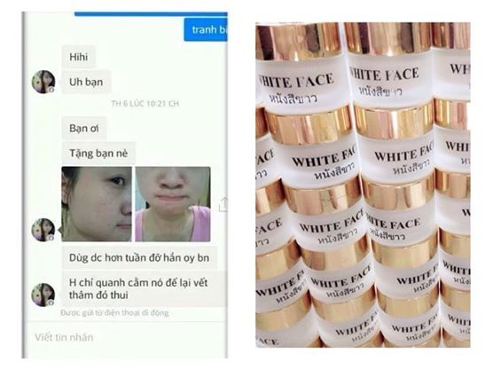 kem duong trang da white face 7