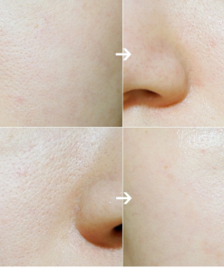 nuoc hoa hong lam sang da innisfree whitening pore skin 7