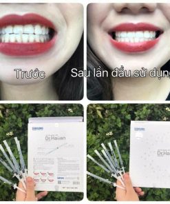 gel-lam-trang-rang-dr-haiian-proessional-clinic-10