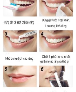 gel-lam-trang-rang-dr-haiian-proessional-clinic-4