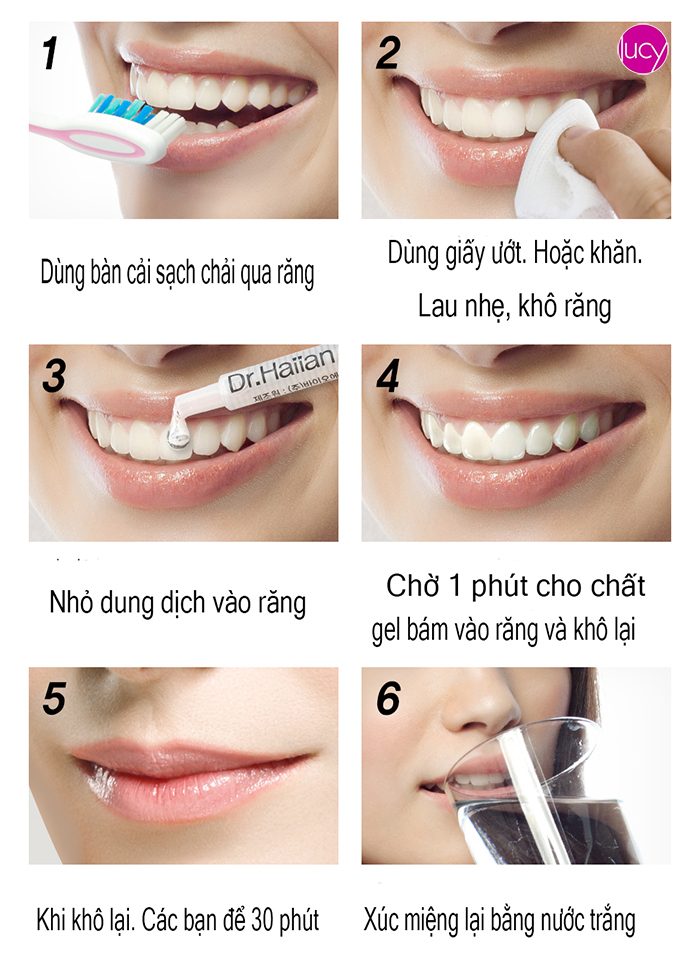 gel-lam-trang-rang-dr-haiian-proessional-clinic-4 gel-lam-trang-rang-dr-haiian-proessional-clinic-4