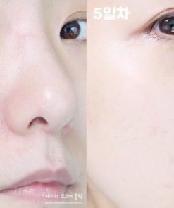 mamonde-aqua-peel-peeling-gel-13