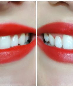 mieng dan trang rang crest 3d white brilliance supreme flexfit 11
