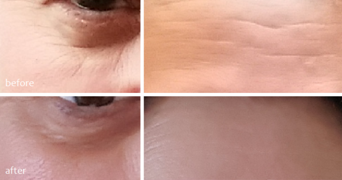 serum-chong-lao-hoa-timeless-pure-natural-serum-19 serum-chong-lao-hoa-timeless-pure-natural-serum-19