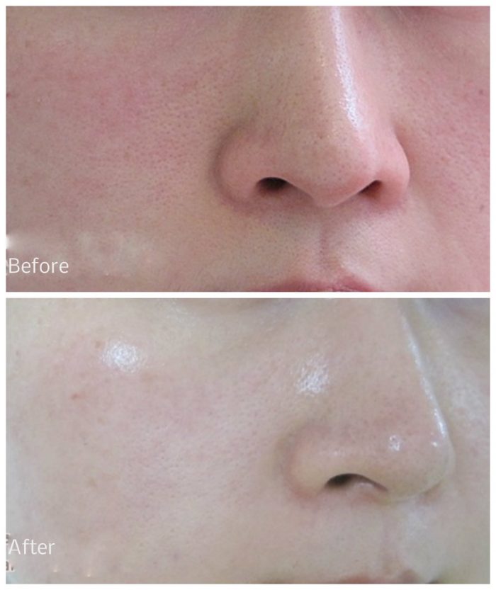 serum-chong-lao-hoa-timeless-pure-natural-serum-8 serum-chong-lao-hoa-timeless-pure-natural-serum-8