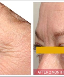 serum-chong-lao-hoa-timeless-pure-natural-serum-9