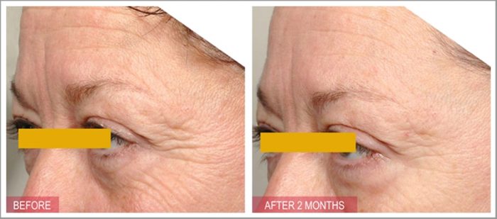 serum-chong-lao-hoa-timeless-pure-natural-serum-9 serum-chong-lao-hoa-timeless-pure-natural-serum-9