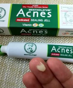 kem tri mun acnes nhat ban 9