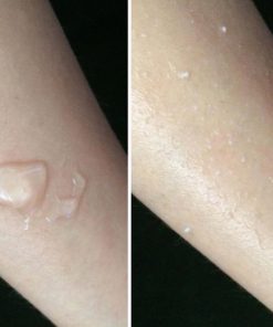 tay da chet botanical natural peeling gel 3