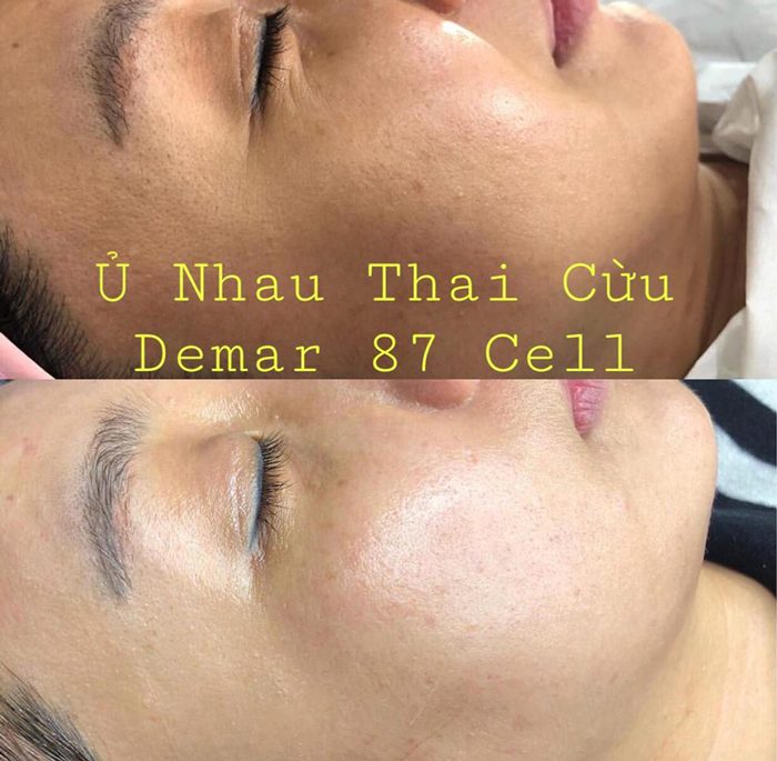 u trang mat nhau thai cuu demar87 cell 12