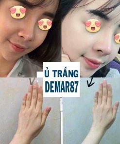 u trang mat nhau thai cuu demar87 cell 9