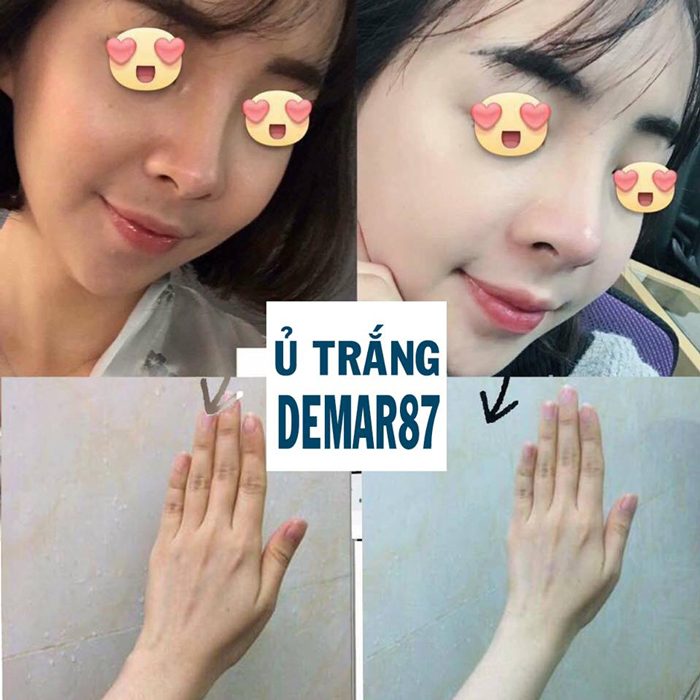 u trang mat nhau thai cuu demar87 cell 9
