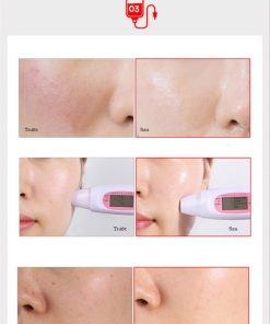 te bao goc the yoppa garden stem cell pure blood ex10
