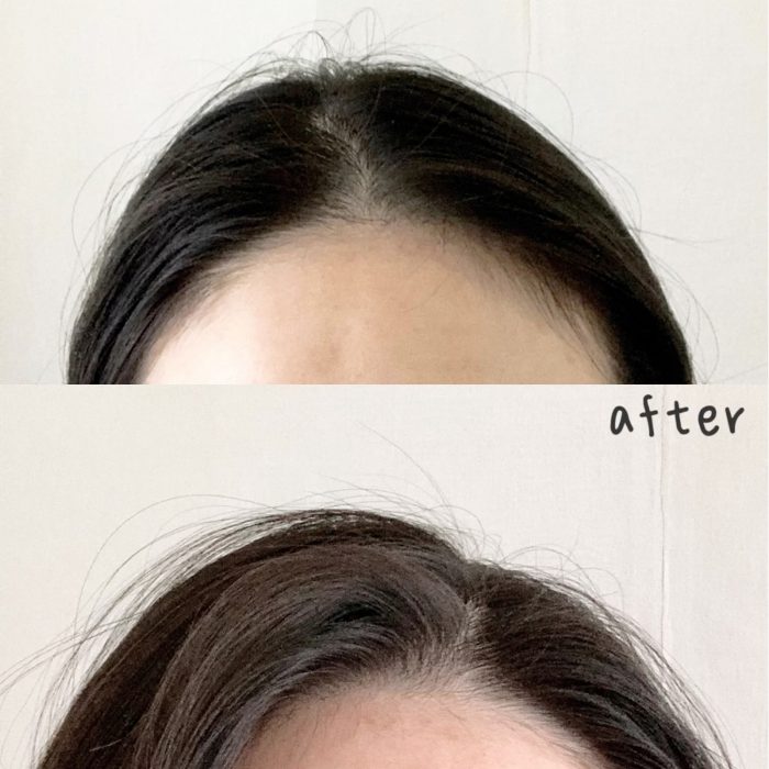 Dầu gội Dr.FORHAIR Folligen Plus Shampoo