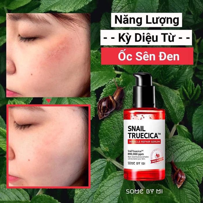 Review Snail Truecica Miracle Repair Some By Mi】