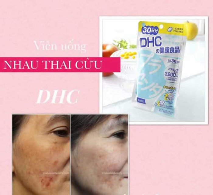 vien uong nhau thai dhc placenta nhat ban 60 vien 20 ngay 4