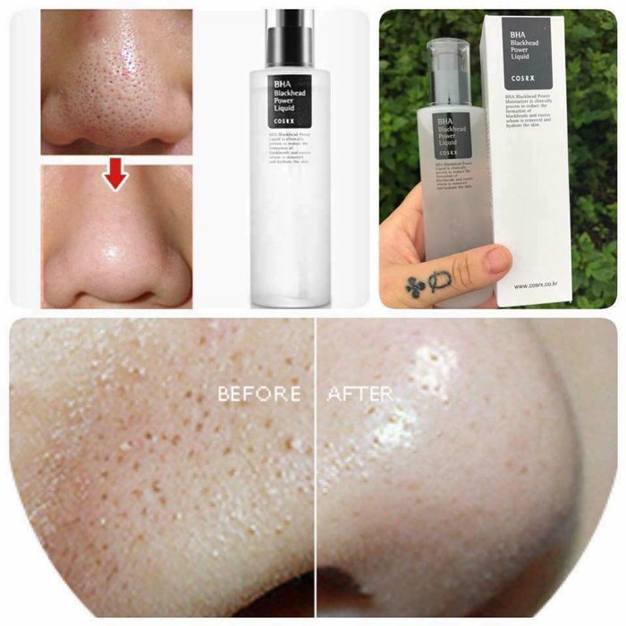 tinh chat cosrx bha blackhead power liquid 8