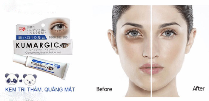 Kem trị thâm quầng mắt Kumargic EYE của Nhật 11