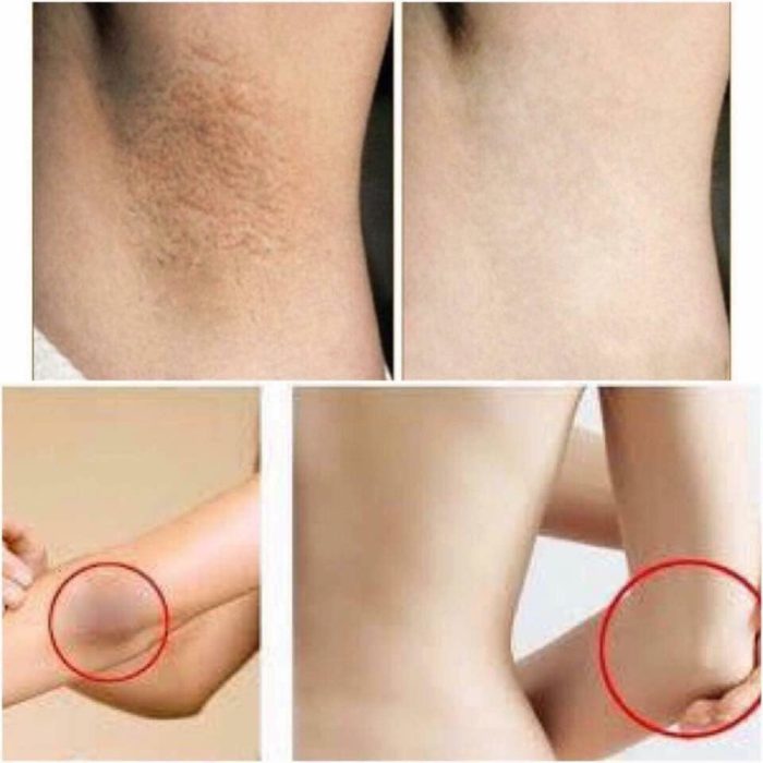 kem lam trang vung da duoi canh tay vacosi whitening armpit cream 8