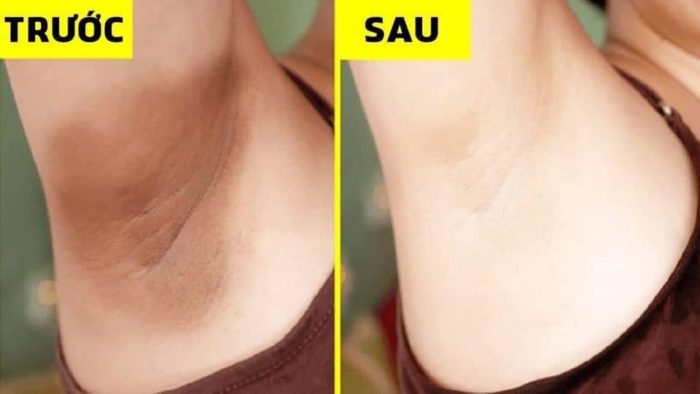 kem lam trang vung da duoi canh tay vacosi whitening armpit cream 9