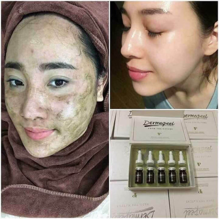 thay da sinh hoc vi kim tao song dermapeel from the nature 8