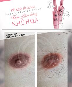 glob a premium cream kem chuyen biet vung nhu hoa n a 7