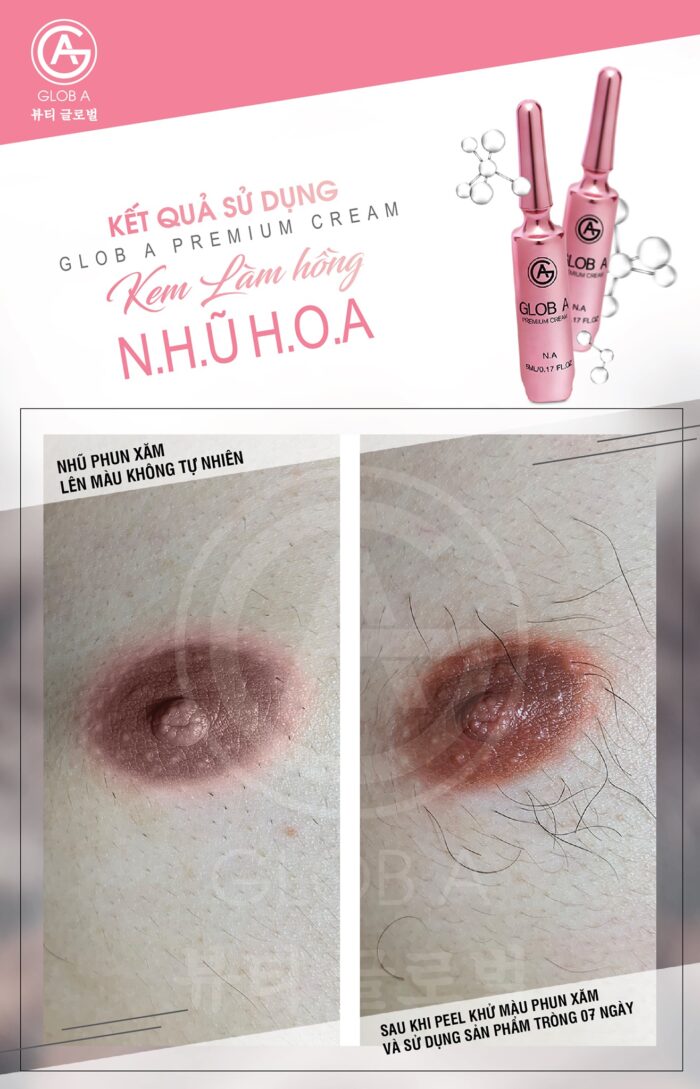 glob a premium cream kem chuyen biet vung nhu hoa n a 7