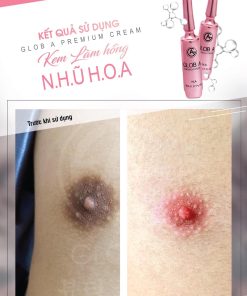 glob a premium cream kem chuyen biet vung nhu hoa n a 9