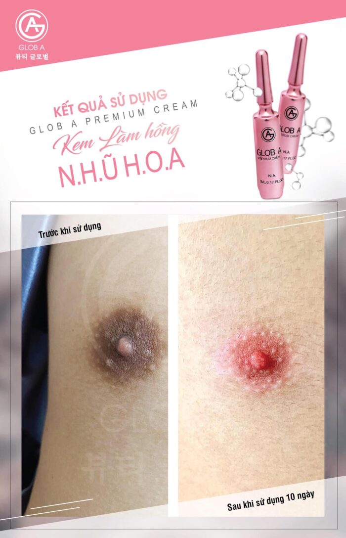 glob a premium cream kem chuyen biet vung nhu hoa n a 9