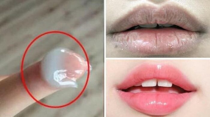 son duong moi blistex lip medex 8