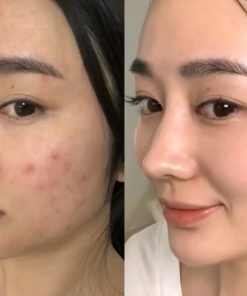 tay te bao chet paulas choice skin perfecting 2 bha liquid exfoliate 9