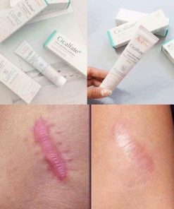 kem lien seo lam mo vet tham avene cicalfate creme reparatrice protectrice 9