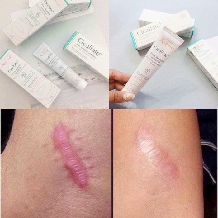 kem lien seo lam mo vet tham avene cicalfate creme reparatrice protectrice 9