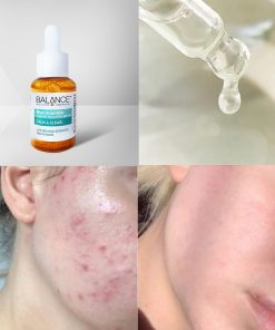 tinh chat balance active formula niacinamide 15 blemish recovery serum 8