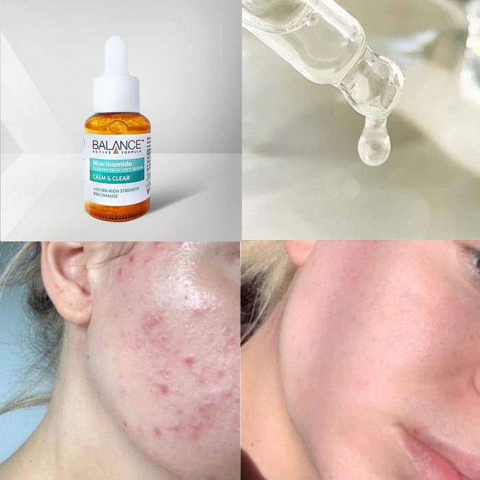 tinh chat balance active formula niacinamide 15 blemish recovery serum 8