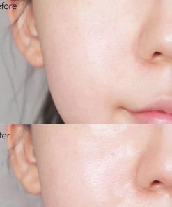 tinh chat trang da melasma x glutathione whitening cica ampoule 9
