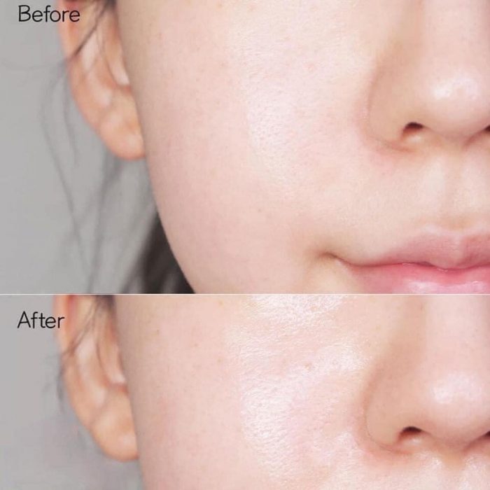 tinh chat trang da melasma x glutathione whitening cica ampoule 9