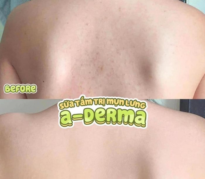 Sữa Tắm A-Derma Gel Douche Hydra-Protecteur Peaux Fragiles Flacon