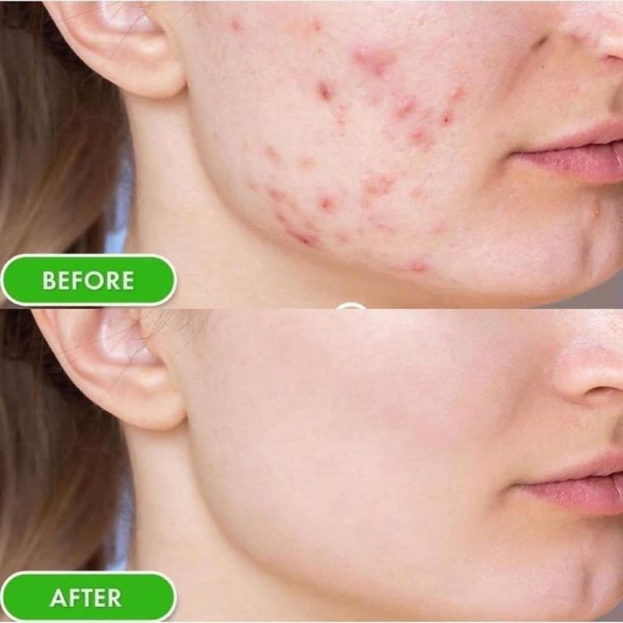 Kem dưỡng SVR Sebiaclear Mat Pores