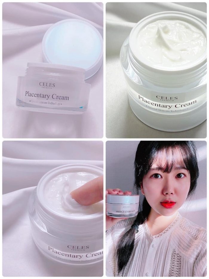 Kem trắng da trị nám Celes Placentary Cream