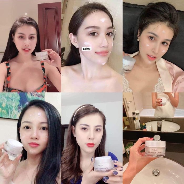Kem trắng da trị nám Celes Placentary Cream