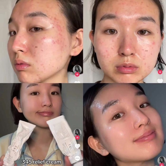 Kem dưỡng Dr.Althea 345 Relief Cream