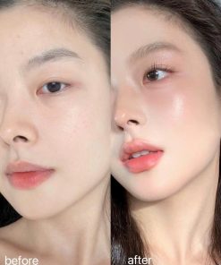 phan nuoc renoderm11