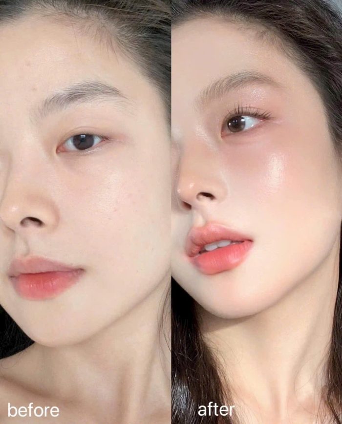 Phấn Nước Renoderm Cushion