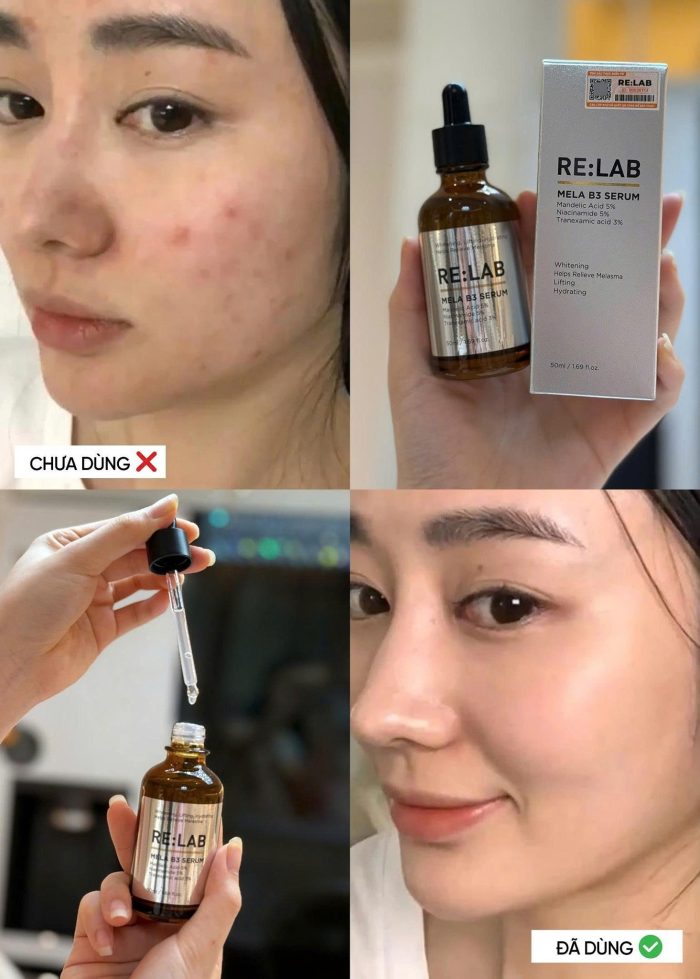 Serum Relab Mela B3
