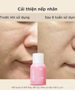 candid retinol8