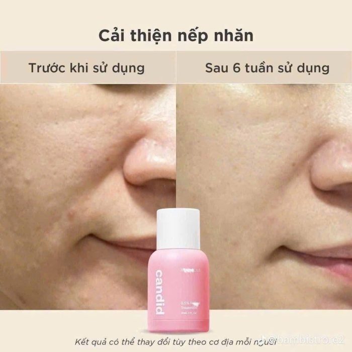 Tinh Chất Candid Retinol Treatment