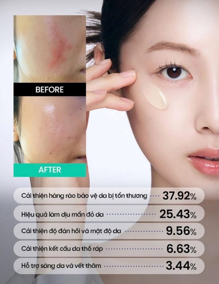 Kem Dưỡng Beplain Cica PDRN Repair Cream